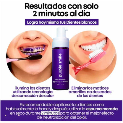 PURPLE GLOW SMILE- BLANQUEADOR DENTAL🦷😄😁