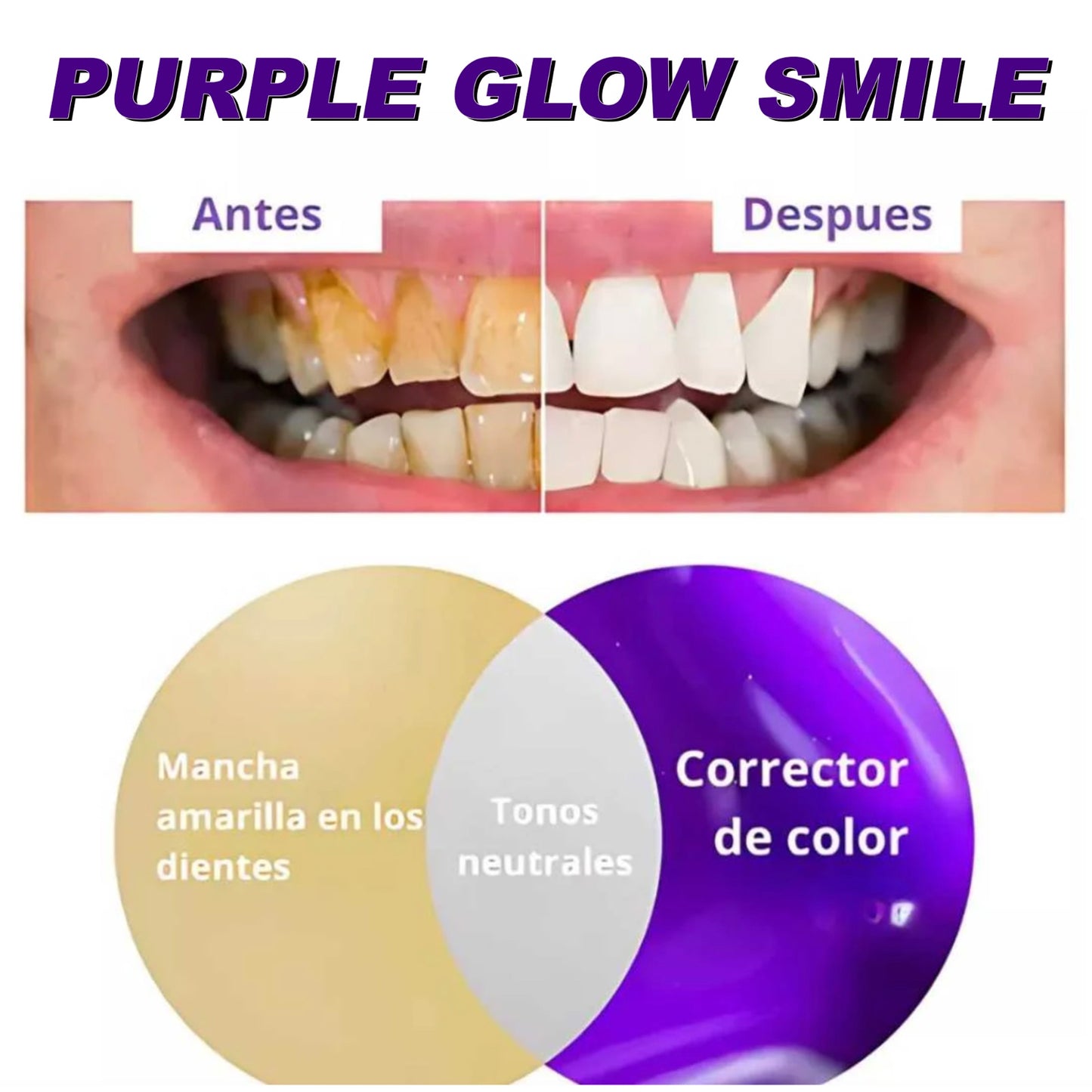 PURPLE GLOW SMILE- BLANQUEADOR DENTAL🦷😄😁